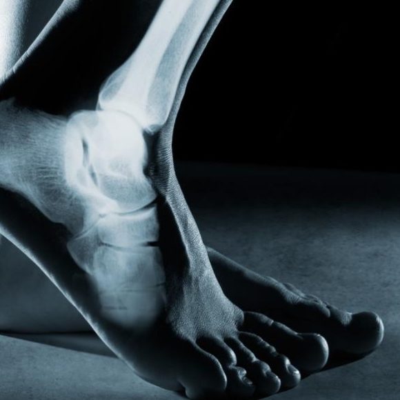 Tips To Take Care of Ankle Joint