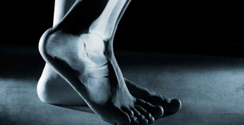 Tips To Take Care of Ankle Joint