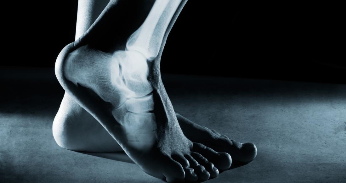 Tips To Take Care of Ankle Joint