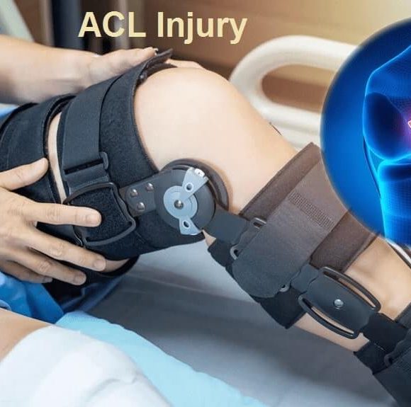 How to Prevent an ACL Injury?